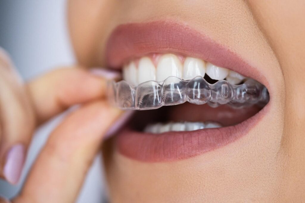 Orthodontic Treatments dentist Vero Beach FL